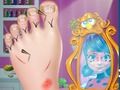 Ladybug Foot Surgery 