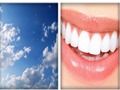 4x1 Picture Quiz 