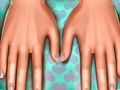Skin doctor: Hands 