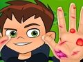 Ben10 Hand Doctor 