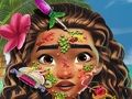 Moana Skin Doctor 