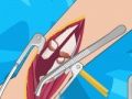 Arm surgery 2 Arm surgery 2