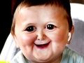 Funny Hasbulla Face 