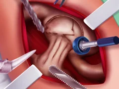 Princess Hips Surgery — free online game