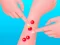 Pimple Poper Rush — free online game