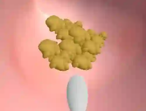 Earwax Clinic — free online game