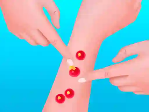 Pimple Poper Rush — free online game