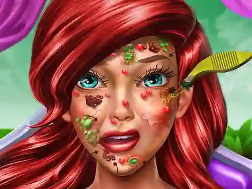Princess Mermaid Skin Doctor — free online game