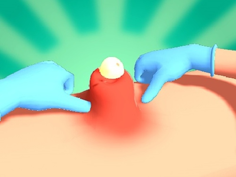 Pimple Squeeze