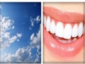 4x1 Picture Quiz 