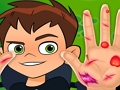 Ben10 Hand Doctor 