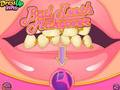Bad Teeth Makeover 
